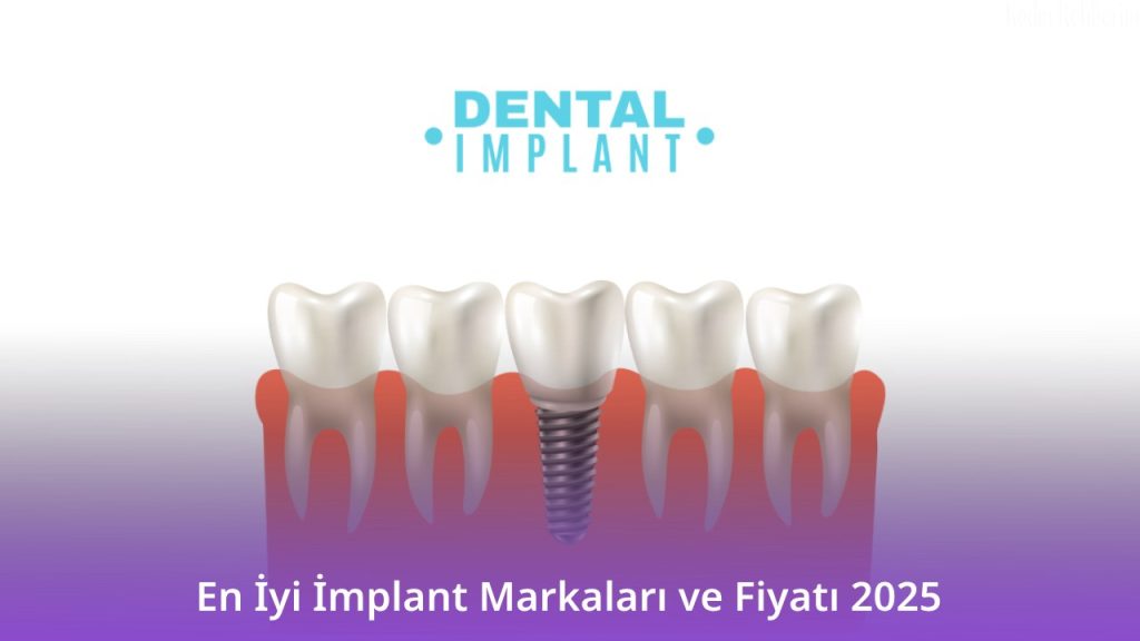 En İyi İmplant Markaları ve Fiyatı 2025