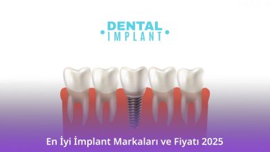 En İyi İmplant Markaları ve Fiyatı 2025