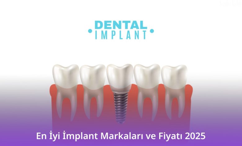 En İyi İmplant Markaları ve Fiyatı 2025